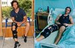 Milan Peroutka po 13 dnech a dvou operacích opustil nemocnici