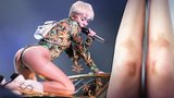 Nechutnosti na jevišti si vyžádaly své: Takhle si vulgární Miley Cyrus otřískala kolena!