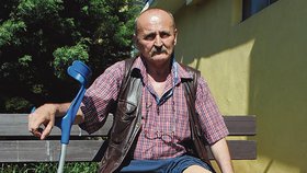 Miloš Kádner (60) viní nemocnici ze zbytečné amputace své nohy. Požaduje za to 25 milionů korun.