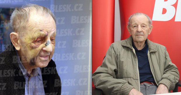 Komunista Milouš Jakeš (94) skončil s pobitým obličejem: Kdo ho takhle brutálně zřídil?