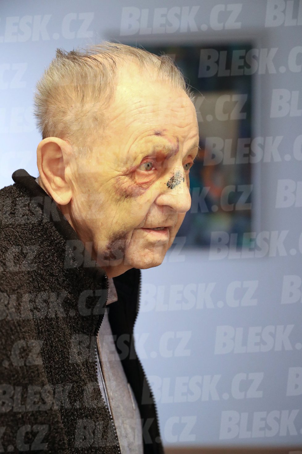 Bývalého generálního tajemníka ÚV KSČ Milouše Jakeše ošklivě srazilo auto.