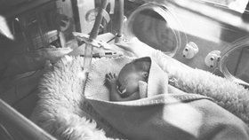 Předčasně narozené děti tráví v inkubátoru desítky dní, často se zavedenou hadičkou pod nos...