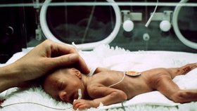 Co prožívají rodiče, kterým se narodí miminko předčasně? Obrovský strach a zároveň i velkou naději. Ilustrační foto
