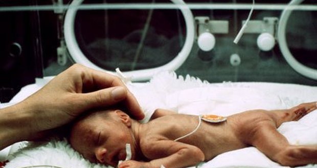 Zpověď matky předčasně narozeného chlapečka: Prosila jsem, aby zůstal se mnou!