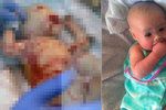 Lékaři se domnívali, že nepřežije ani týden, přesto však nedávno oslavila už první narozeniny. Malá bojovnice jménem Harper Foy, která se narodila bez kůže.