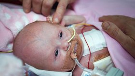Malá Vanellope se narodila se srdcem mimo tělo. Podle doktorů byla minimální šance, aby přežila. Dnes je jí 14 měsíců a konečně může z nemocnice domů