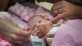 Malá Vanellope se narodila se srdcem mimo tělo. Podle doktorů byla minimální šance, aby přežila. Dnes je jí 14 měsíců a konečně může z nemocnice domů