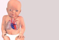 Bratislava: Lékaři transplantovali srdce malému miminku