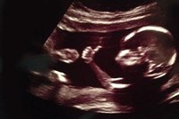 Všechno je v pohodě, mami: Ultrazvuk odhalil nejpohodovější miminko ještě před narozením!