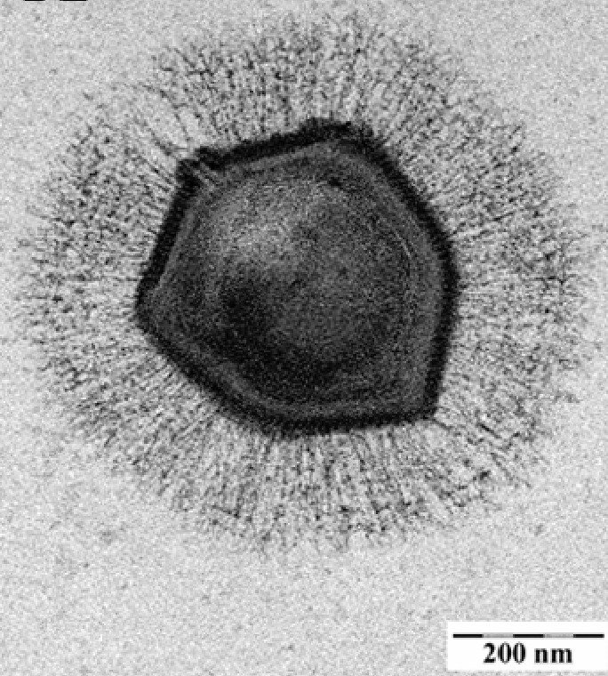 Mimivirus byl první známý obří virus