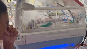 Holčička se narodila ve 21. týdnu a přežila. Vážila jen 351 gramů.