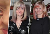 Češi jí dali miliony na novou tvář: Mirka už má po zákroku. Bez vás by to nešlo, vzkazuje