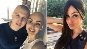 Miss (28) bojuje s rakovinou dělohy: Vypadaly jí vlasy, manžel se kvůli ní také oholil