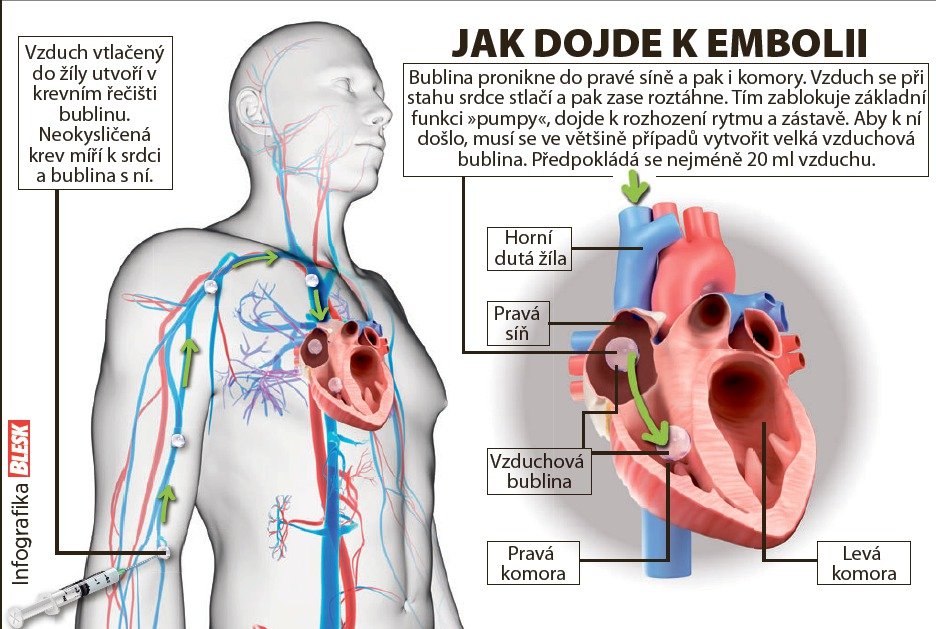 Jak dojde k embolii.