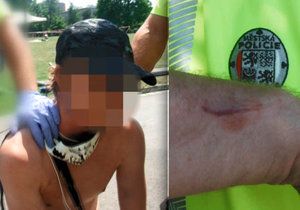Agresivní opilý muž pokousal strážníka městské policie. Ten ho zatkl kvůli narušování dětského dne na Pankráci.