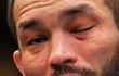 Bolestivé zranění oka Machmuda Muradova v UFC Bolestivé zranění oka Machmuda Muradova v UFC