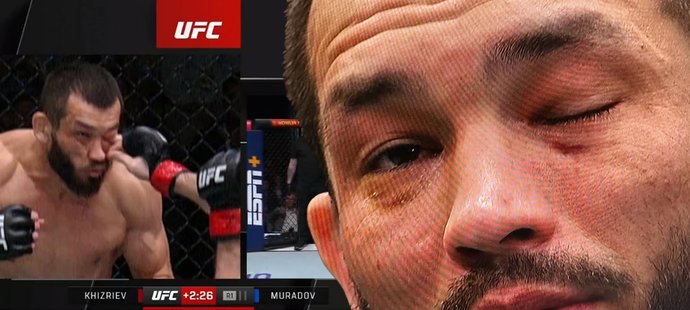 Muradov trpěl v UFC, bodnutí do oka a zrušený zápas. Palec cítil až v mozku