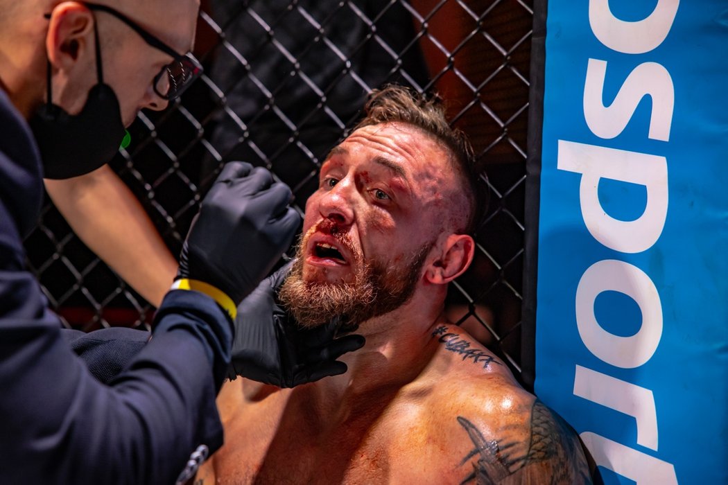 Nejúspěšnější český kickboxer Matěj Peňáz porazil ve své MMA premiéře Patrika Jevického.