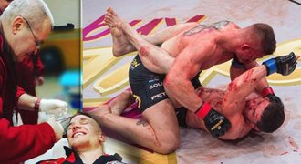 Dohra krvavé řežby v kleci MMA: Doktor mohl Petráškovi omylem zašít oko!