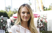 Topmodelka Candice Swanepoel: Porazila anorexii!