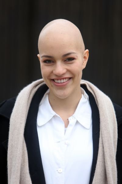 Julie má za sebou několik chemoterapií, kvůli který přišla o vlasy