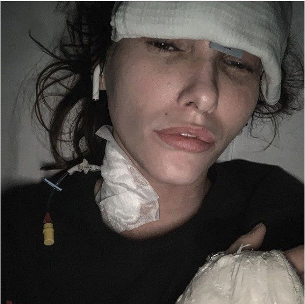 Modelka Jekatěrina promluvila o svých zraněních.
