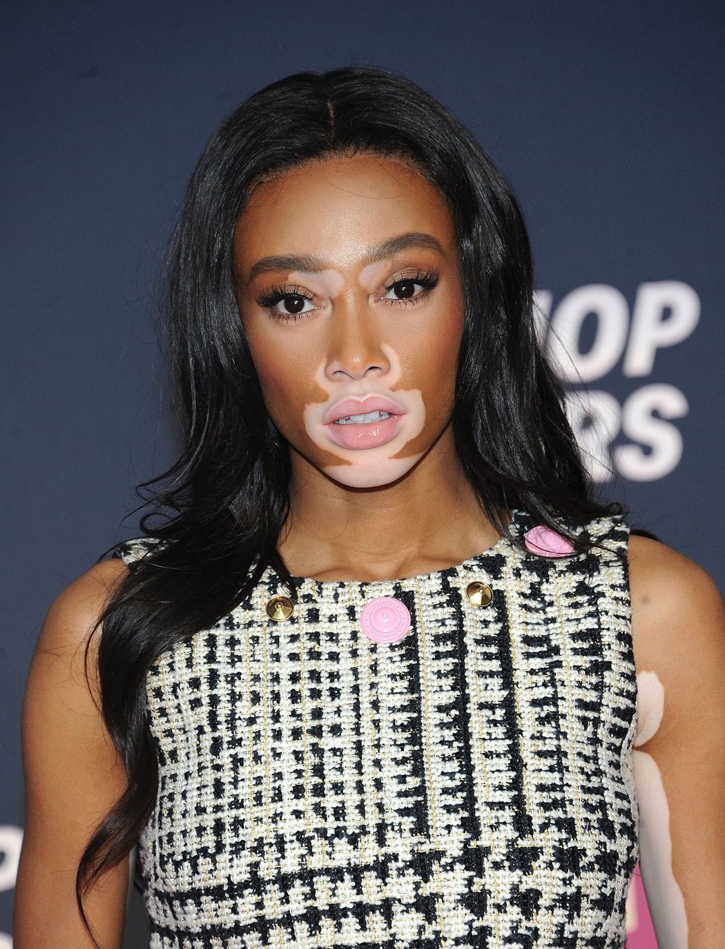 Modelka Winnie Harlow