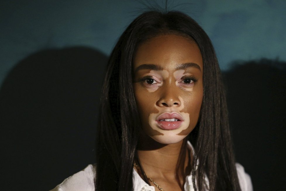 Modelka Winnie Harlow