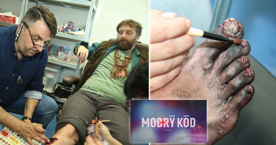 Jak se dělají zranění v seriálu Modrý kód?