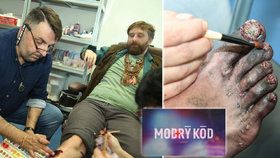 Seriál Modrý kód: Jak se vyrábí nechutná poranění?