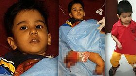 Malý Mohammed přišel při vlakové nehodě o obě nohy. Lékaři mu je ale přišili a chlapec už se naučil znovu chodit.