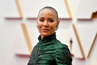 Další hvězda trpí alopecií. Kterým celebritám padají nezřízeně vlasy?