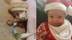Dívka vážila 450 gramů a hrozilo, že zemře: Teď ale oslavila první Vánoce