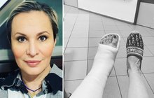 Monika Absolonová si zlomila nohu: Bude zpívat vsedě?! 