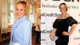 Absolonová po operaci září ve Varech: Přiznala bolestivé utrpení!