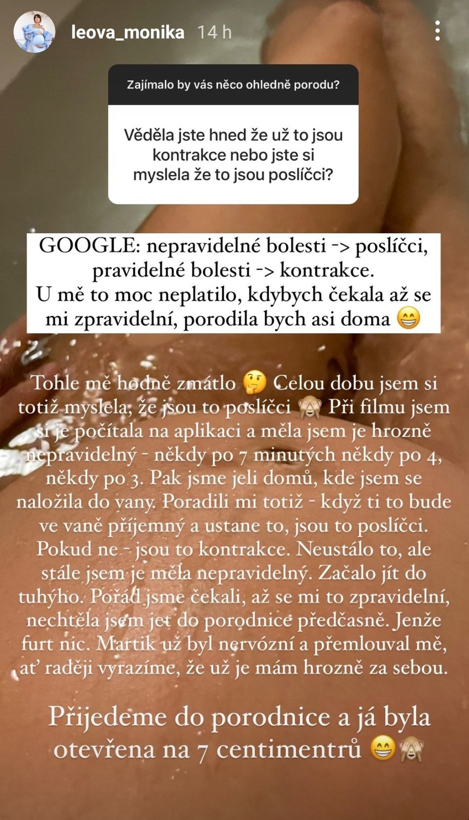 Monika Leová otevřeně o porodu