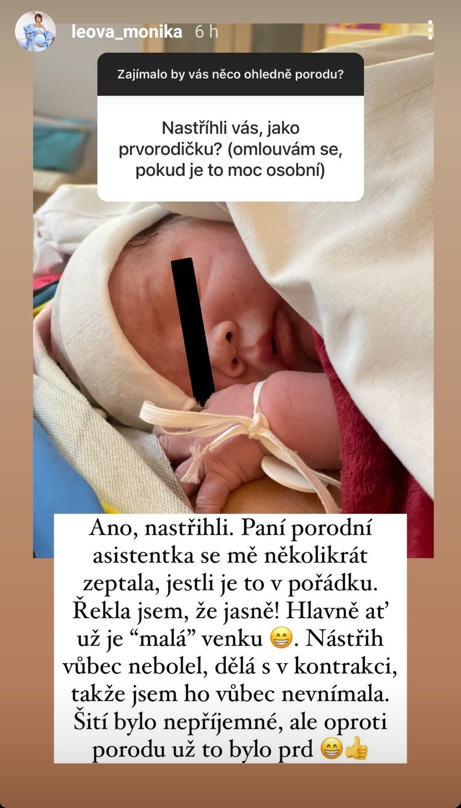 Monika Leová otevřeně o porodu