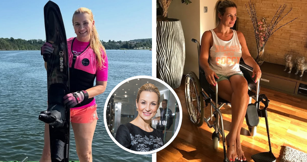 Marešova exmanželka Monika ukázala následky děsivého úrazu.