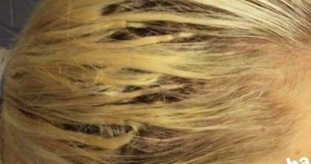 Charlotte zveřejnila fotky zničených vlasů.
