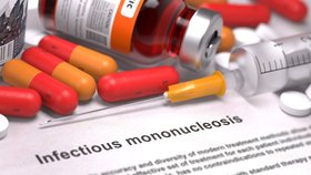Mononukleóza se často zaměňuje s angínou.