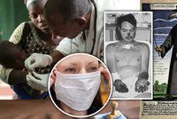 Pět nejhorších pandemií v historii: Chřipka, AIDS i neštovice mají na svědomí miliony lidí!