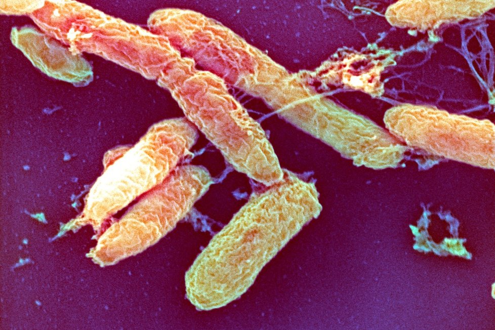 Yersinia Pestis, bakterie způsobující morovou nákazu