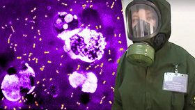 Míří sem další epidemie z Číny? Objevil se zde dýmějový mor! 