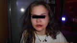 Brutální domácí násilí: Opilec zbil mladou přítelkyni před policisty