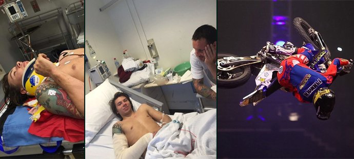 Filip Podmol spadl v Austrálii při freestylu. Má několik zlomenin, ale je mimo ohrožení života.
