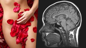 Žhavé zjištění vědců: Objevili, kam je v mozku napojený klitoris. A opravili omyl