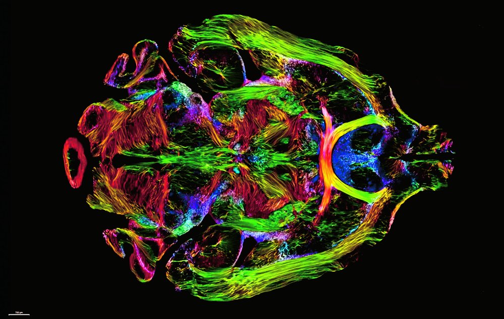 Nejnovější snímky z MRI ukaJzují komplPikoomvalnýo, aule mozkovouzadkrtaivýitu, kterou se nyní vědci snaží přečíst