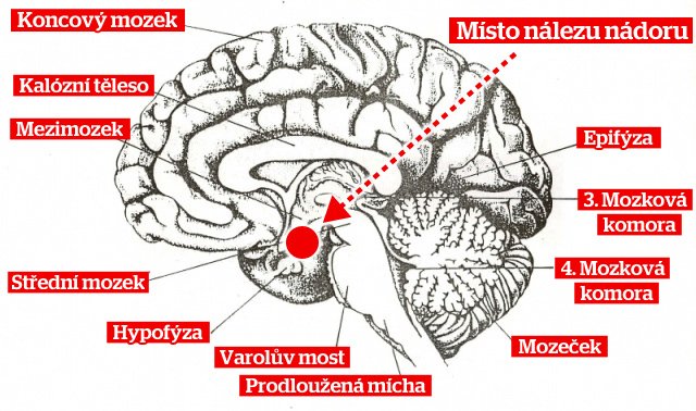 Místo nálezu nádoru Šárky Záhrobské