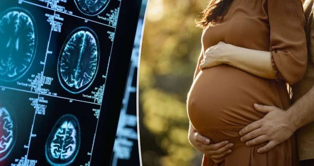 Ilustrační foto: Ženám se v těhotenství mění struktura mozku