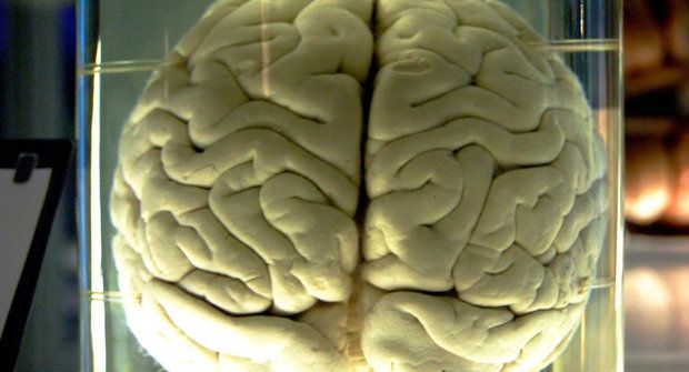 Neurotický otazník: Jak fungují neurony v mozku?